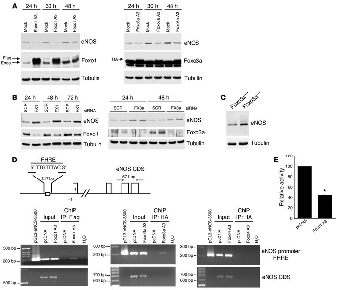 Foxo1 and Foxo3a are transcriptional repressors of eNOS. (A) eNOS expres...