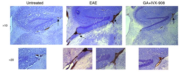 BBB integrity in hippocampus section following subcutaneous immunization...