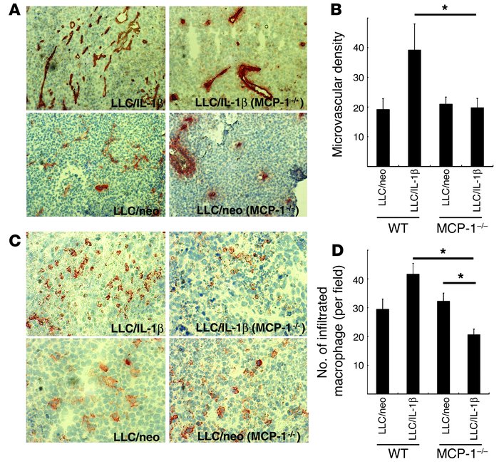 Enhancement of angiogenesis and macrophage infiltration by LLC/IL-1β was...