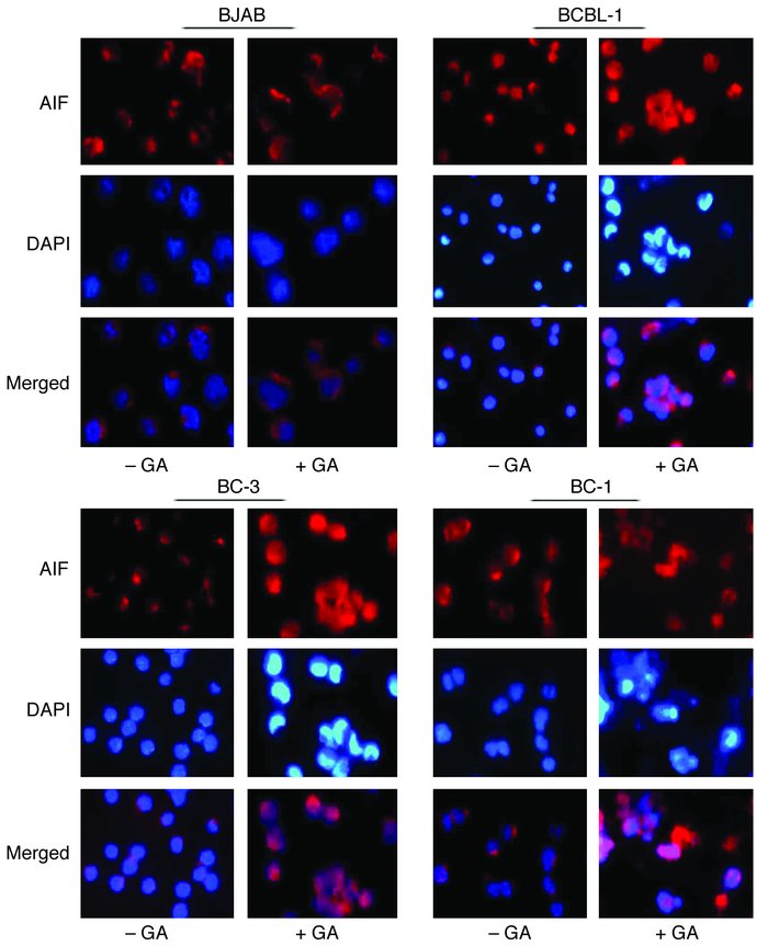 AIF expression. Immunofluorescence analysis was performed with BJAB, BCB...