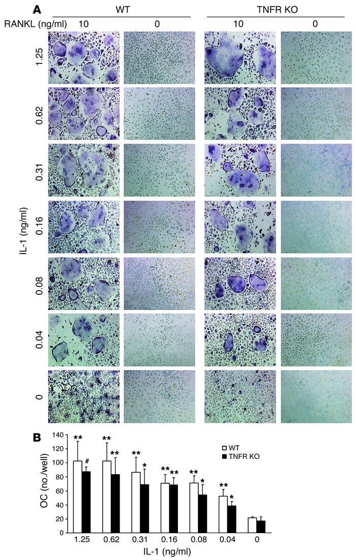 IL-1 directly induces osteoclast precursor differentiation. (A) WT or p5...
