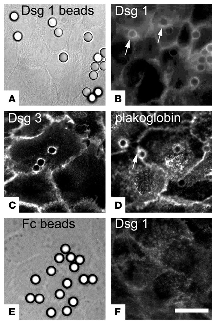 Localization of Dsg1, Dsg3, and plakoglobin at cell-to-bead contacts. Ds...