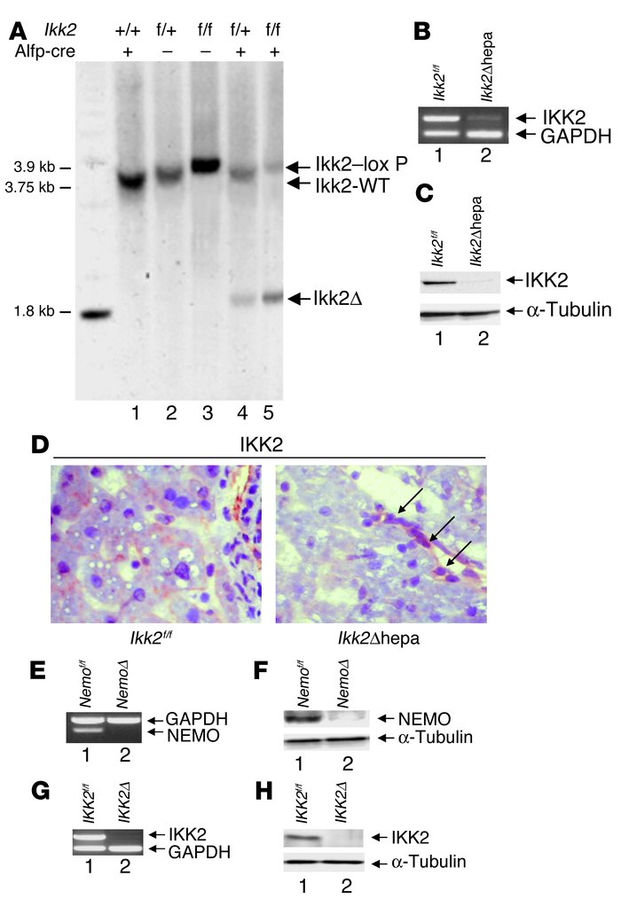 Conditional knockout of Ikk2 and Nemo in the mouse liver. (A) Deletion i...