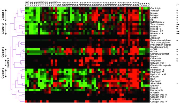 The strongest IgG antiglomerular reactivities in human lupus sera. Sera ...