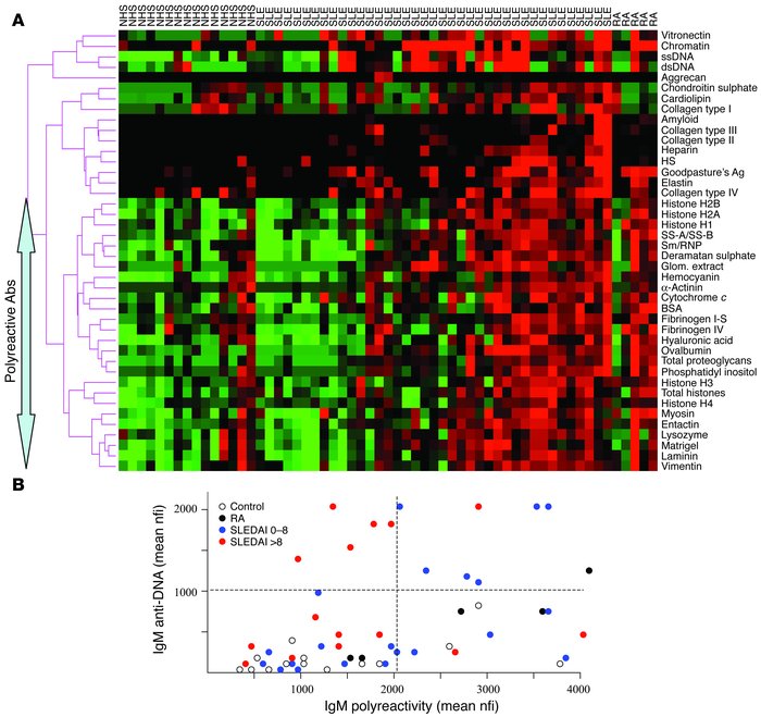 The strongest IgM antiglomerular reactivities in human lupus sera. (A) S...