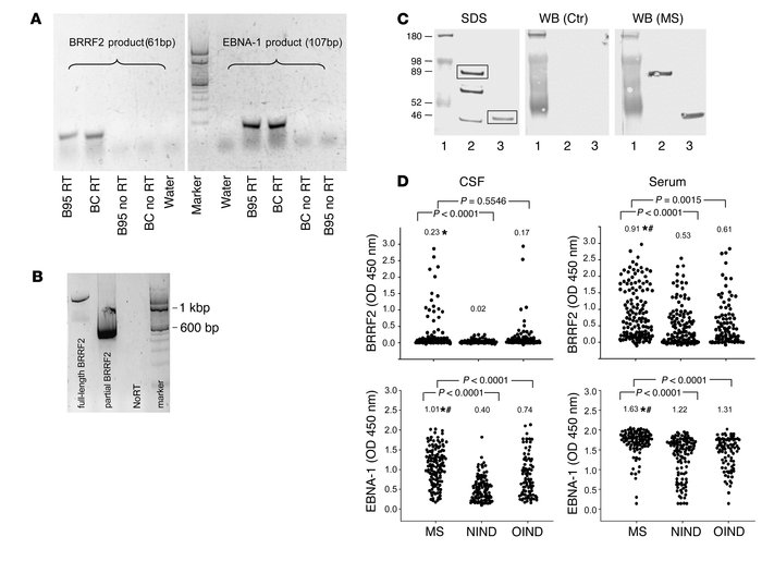 Expression and immunoreactivity to EBNA-1 and BRRF2. (A) BRRF2 and EBNA-...