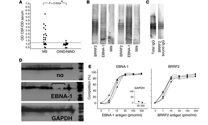 Specific intrathecal IgG response to EBV proteins. (A) Intrathecal IgG r...