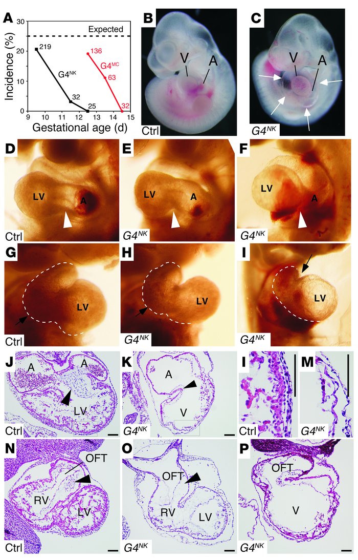 Phenotypic characterization of mutants after early cardiomyocyte-restric...