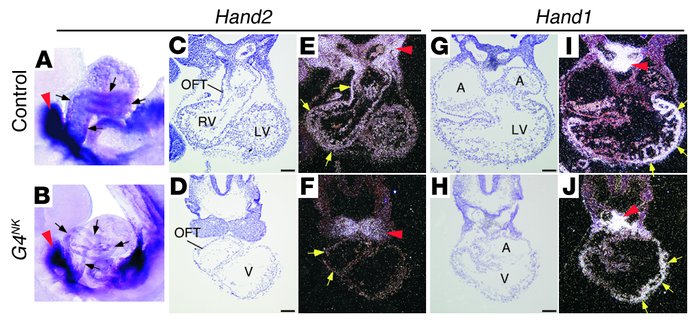 Expression of Hand genes after early myocyte-restricted Gata4 deletion. ...