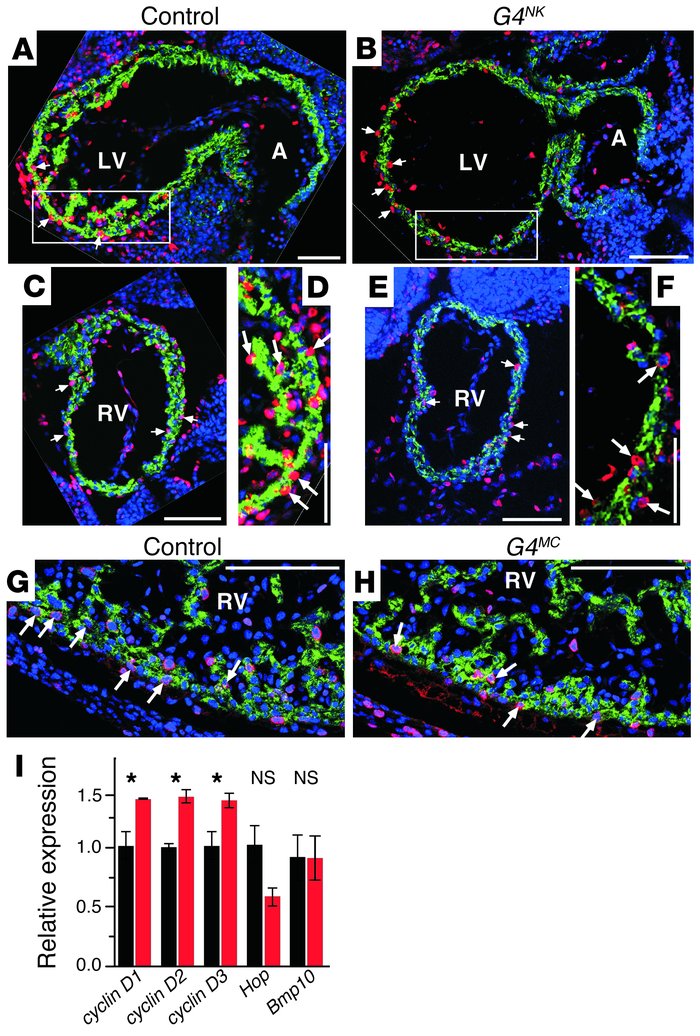 Decreased myocyte proliferation in mutants lacking myocardial Gata4 expr...