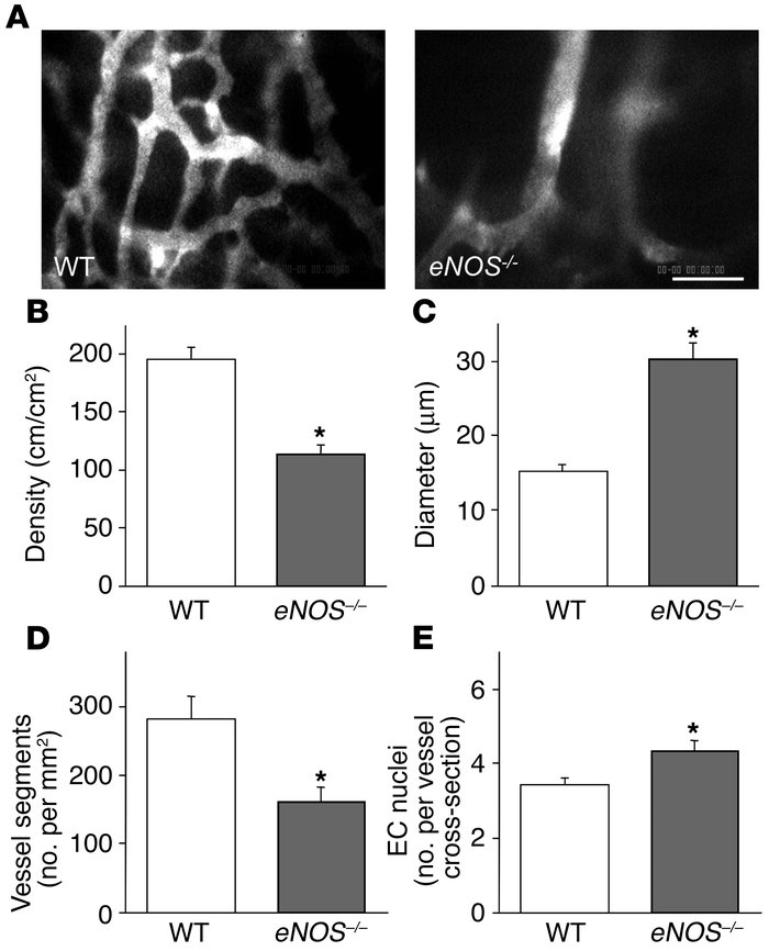 Effect of host eNOS deletion on B16F10 tumor vessels in the cranial wind...