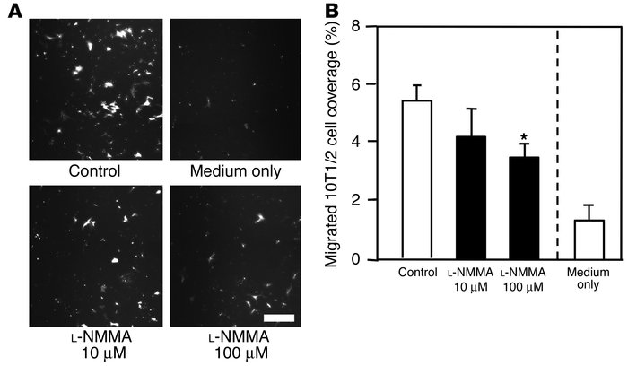 Transwell migration of 10T1/2 cells toward HUVECs. (A) Transmigrated eGF...