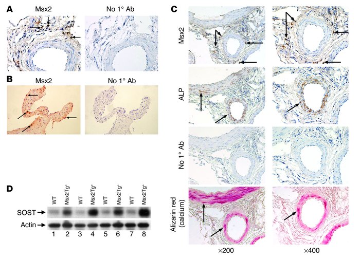 Expression of Msx2 in adventitial cells adjacent to segments of aortic a...