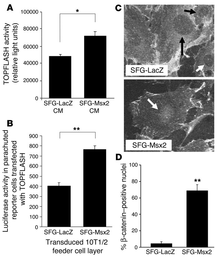 Regulation of TCF/LEF1 activity and β-catenin by Msx2 in 10T1/2 cells. (...