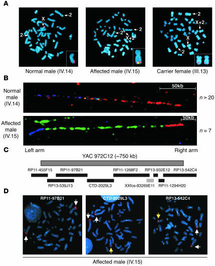 FISH analyses confirm the deletion-insertion involving Xq27.1 and 2p25 i...