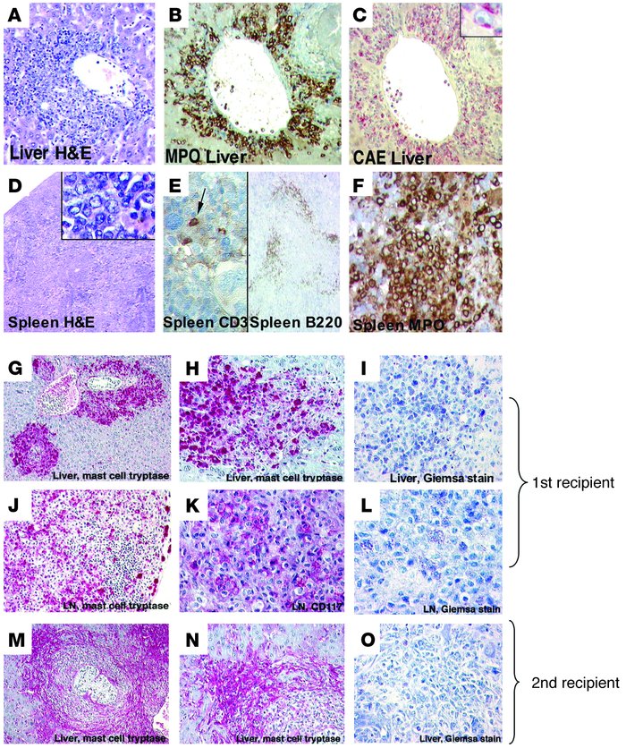 Histological analyses of leukemic mice. (A–F) Histological analyses of A...