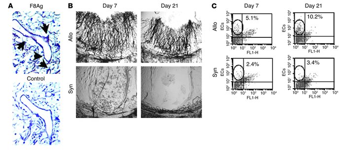 Vascular remodeling occurs during the pathogenesis of murine BOS. (A) Re...