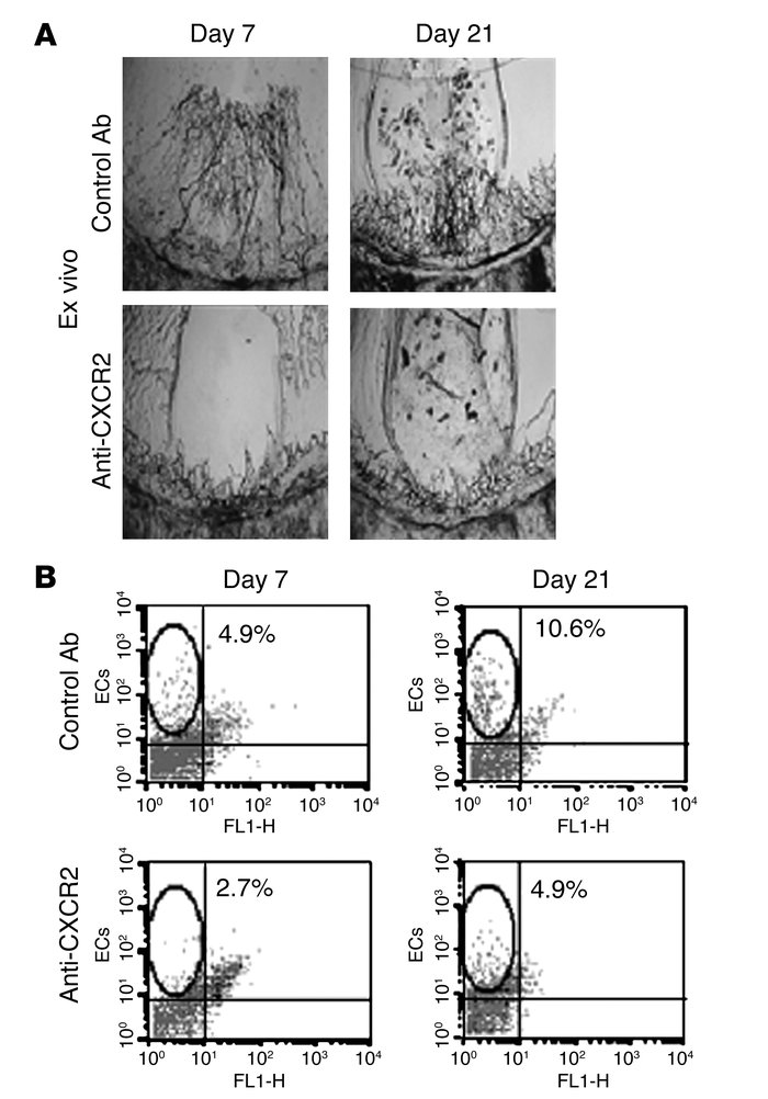 Vascular remodeling and angiogenic activity during murine BOS is attribu...