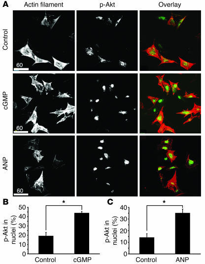 Elevation of cGMP induces rapid nuclear accumulation of activated Akt ki...