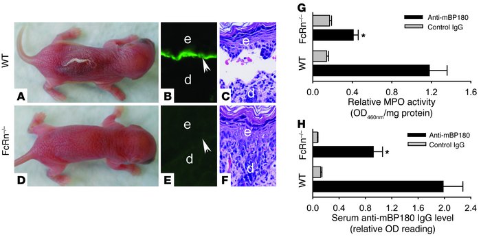 FcRn-deficient mice are resistant to experimental BP. Neonatal WT and Fc...