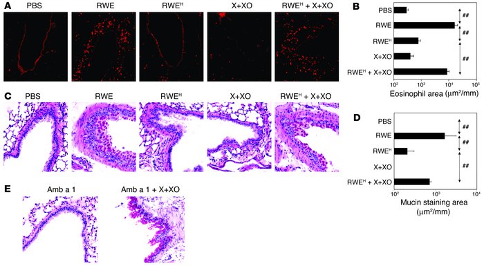 Removal of NADPH oxidase activity from RWE decreases accumulation of eos...