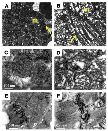 Ultrastructural morphology of cardiomyocytes and mitochondrial defects i...