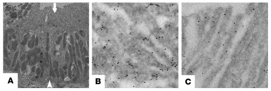 Immunogold localization of Crry in PTECs.
Immunogold labeling of Crry in...