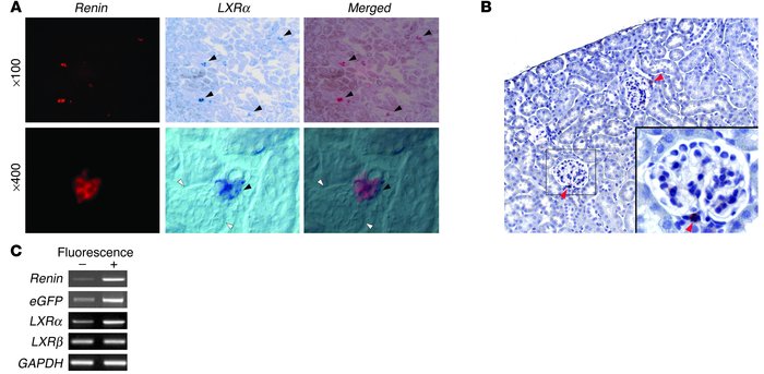 LXRs are coexpressed with renin in JG cells in vivo. (A) Double nonradio...