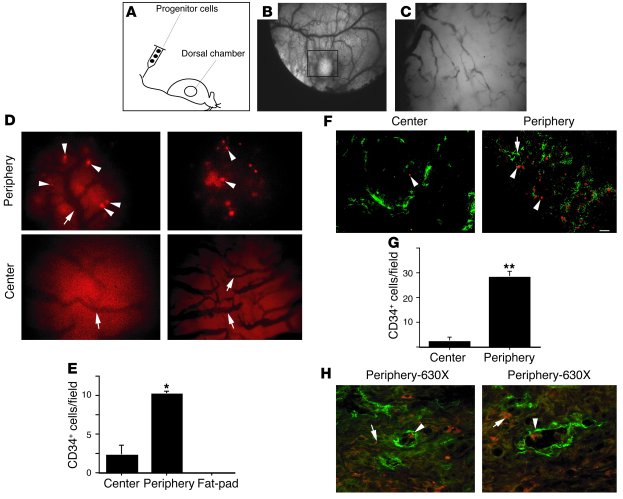 Human CD34+ progenitor cells home to peripheral tumor vasculature. (A) N...