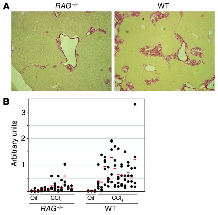 RAG–/– mice show reduction in fibrosis development. RAG–/– or WT BALB/c ...