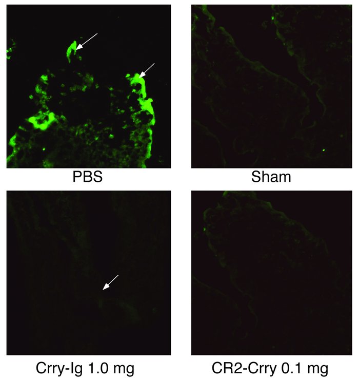 IRI-induced C3 deposition demonstrated by immunofluorescent staining. In...