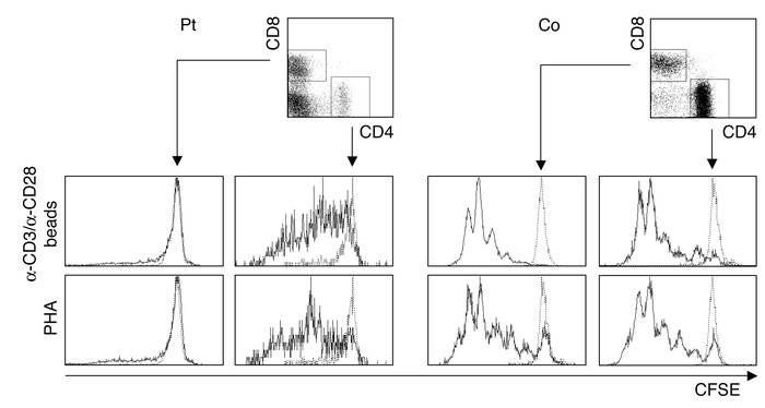 T cell proliferative responses. PBMCs from the patient and a healthy con...