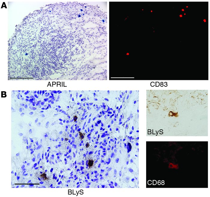 Cellular origin of APRIL and BLyS in rheumatoid synovitis. Frozen tissue...