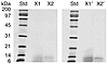 SDS-PAGE of the purified protein with the inhibitory activity against CaOx