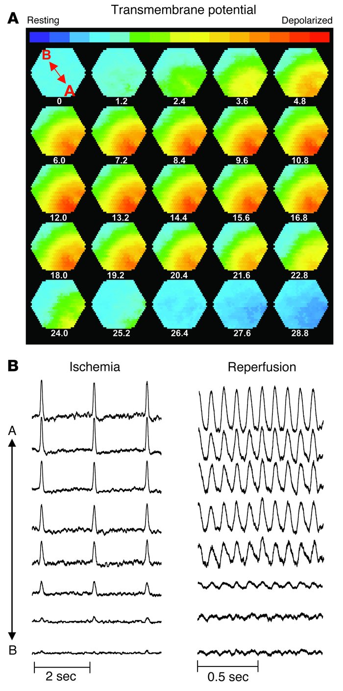 Metabolic sink/block as a mechanism of conduction failure and arrhythmia...
