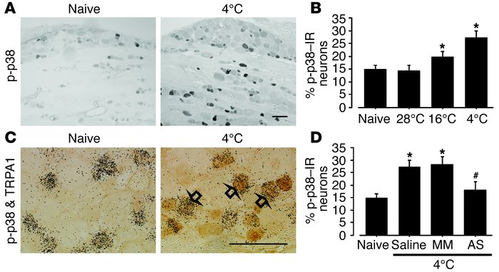 Activation of p38 MAPK in TRPA1-containing neurons by noxious cold stimu...