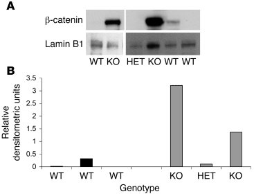 
                  β-catenin expression in epimorphin–/–
               ...