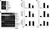 Role of ERK1/2 MAPK in IL-13 regulation of proteases and antiproteases.