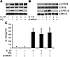 ERK1/2 inhibition in IL-13 Tg mice.