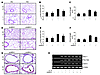 Role of ERK1/2 MAPK in IL-13–induced tissue remodeling responses.