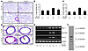 Role of STAT6 in IL-13–induced tissue remodeling responses.