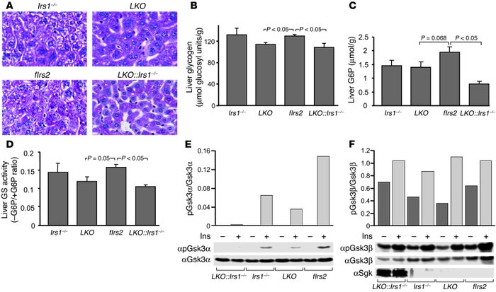 Glycogen synthesis in the LKO::Irs1–/– liver.
               
Liver extr...