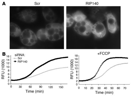 RIP140 is a negative regulator of cellular respiration in 3T3-L1 adipocy...