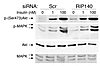 Insulin signaling is not significantly affected by RIP140 silencing.