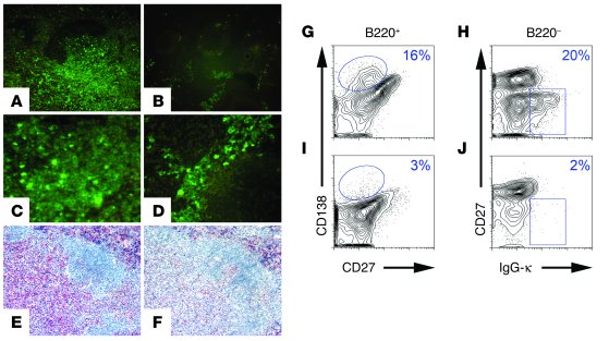 Anaplastic plasmacytoma in a LANA transgenic animal. (A–D) IgG-κ express...