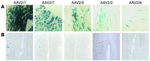 Retrograde transduction of spinal motor neurons by AAV vectors.
Expressi...