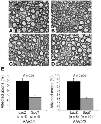 Rescue of the neuropathological phenotype in the peripheral nerve.
(A–D)...