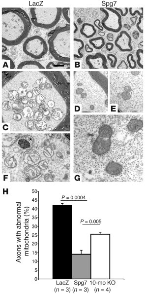 Rescue of the ultrastructural mitochondrial abnormalities.
(A–G) Electro...