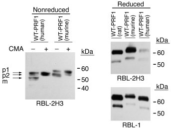 Detection of mouse perforin expressed in RBL cells.
Mouse perforin cDNA ...