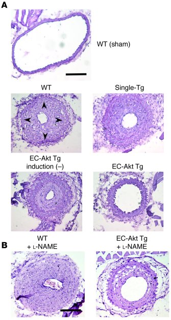 Photomicrographs of ligated mouse carotid arteries. (A) Photomicrographs...